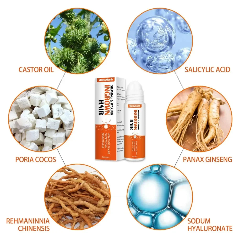 Ingrown Hair Treatment