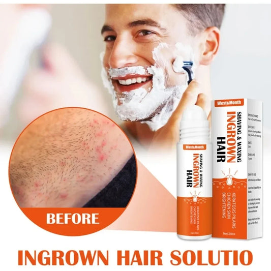 Ingrown Hair Treatment